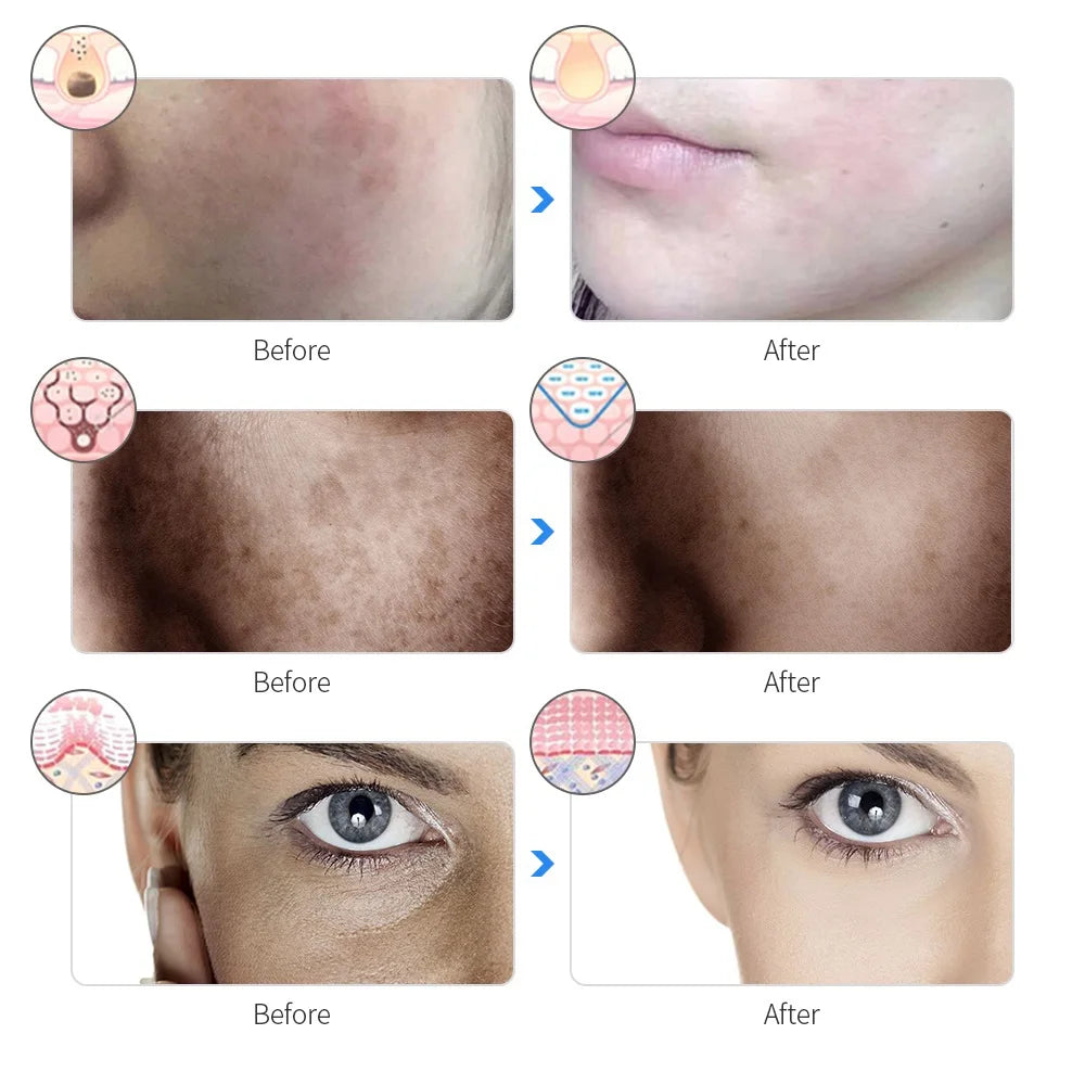7-Color LED Photon Facial Mask – Skin Rejuvenation, Anti-Acne & Wrinkle Reduction